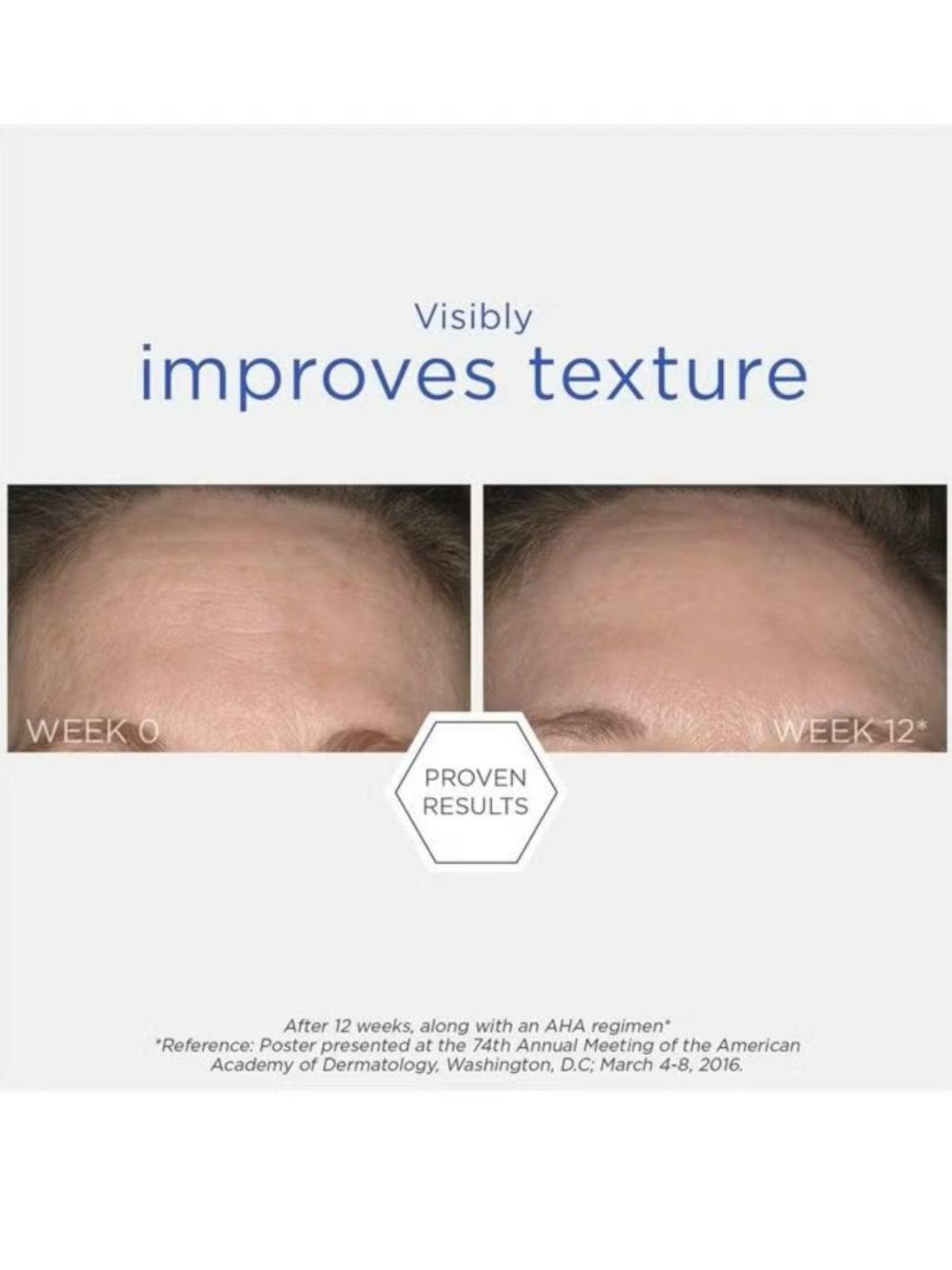 Before and after comparison of skin texture improvement over 12 weeks with text Visibly improves texture' and 'Proven Results. Neostrata, Monza Outlet, Monza Fashion, Shein Outlet