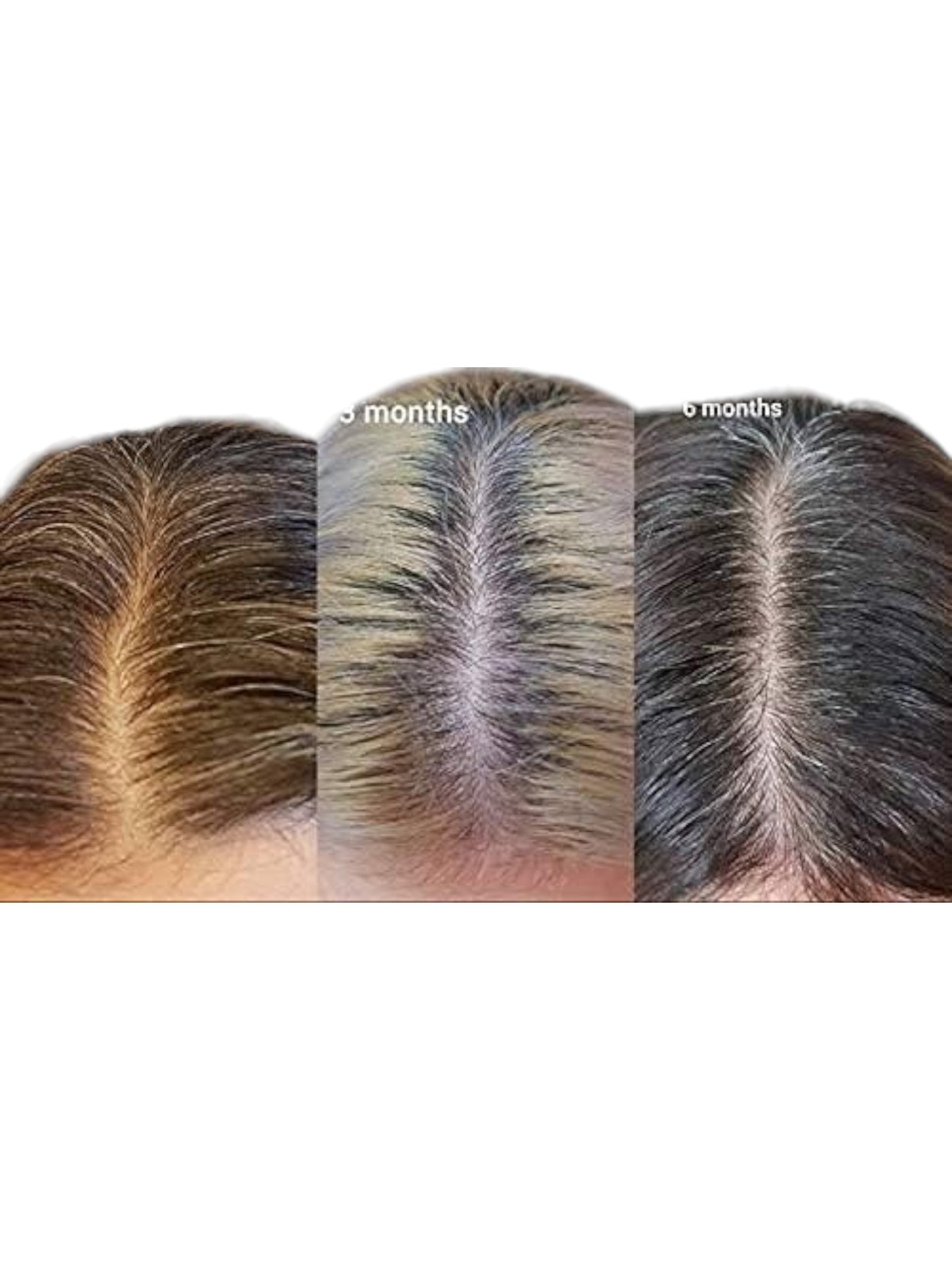 Before and after hair growth comparison over 6 months on a white background Monza fashion outlet, monza outlet, shein outlet, shien outlet cosmetics, makeup, perfume