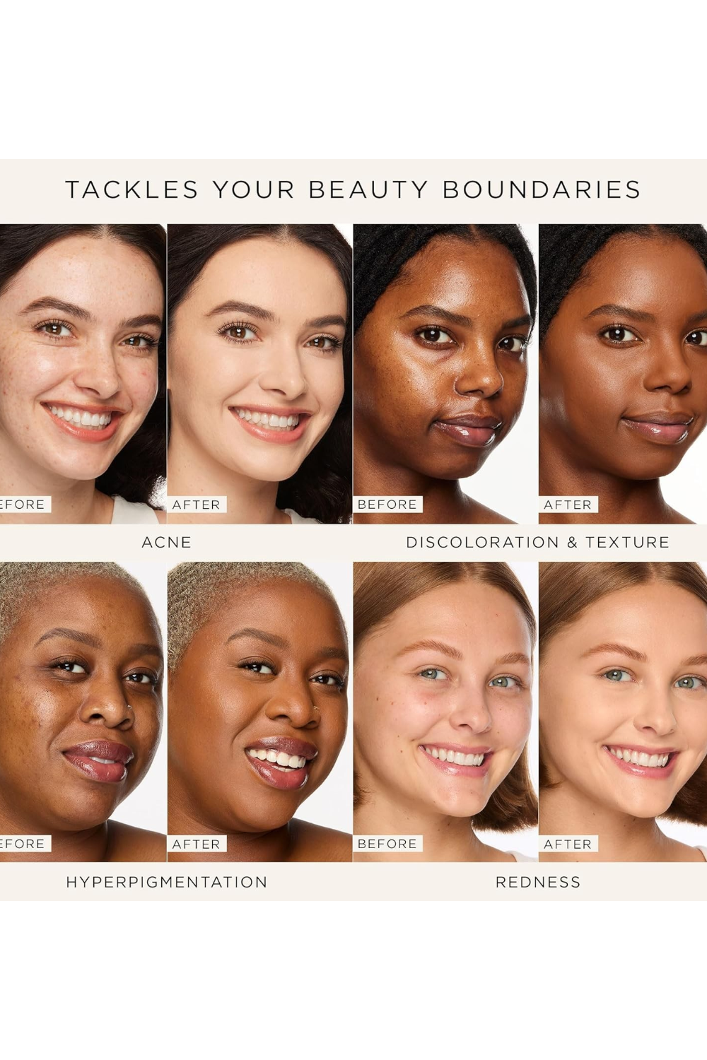 Before and after skin treatment results on various skin tones. Monza fashion outlet, monza outlet, shein outlet, shien outlet cosmetics, makeup, perfume