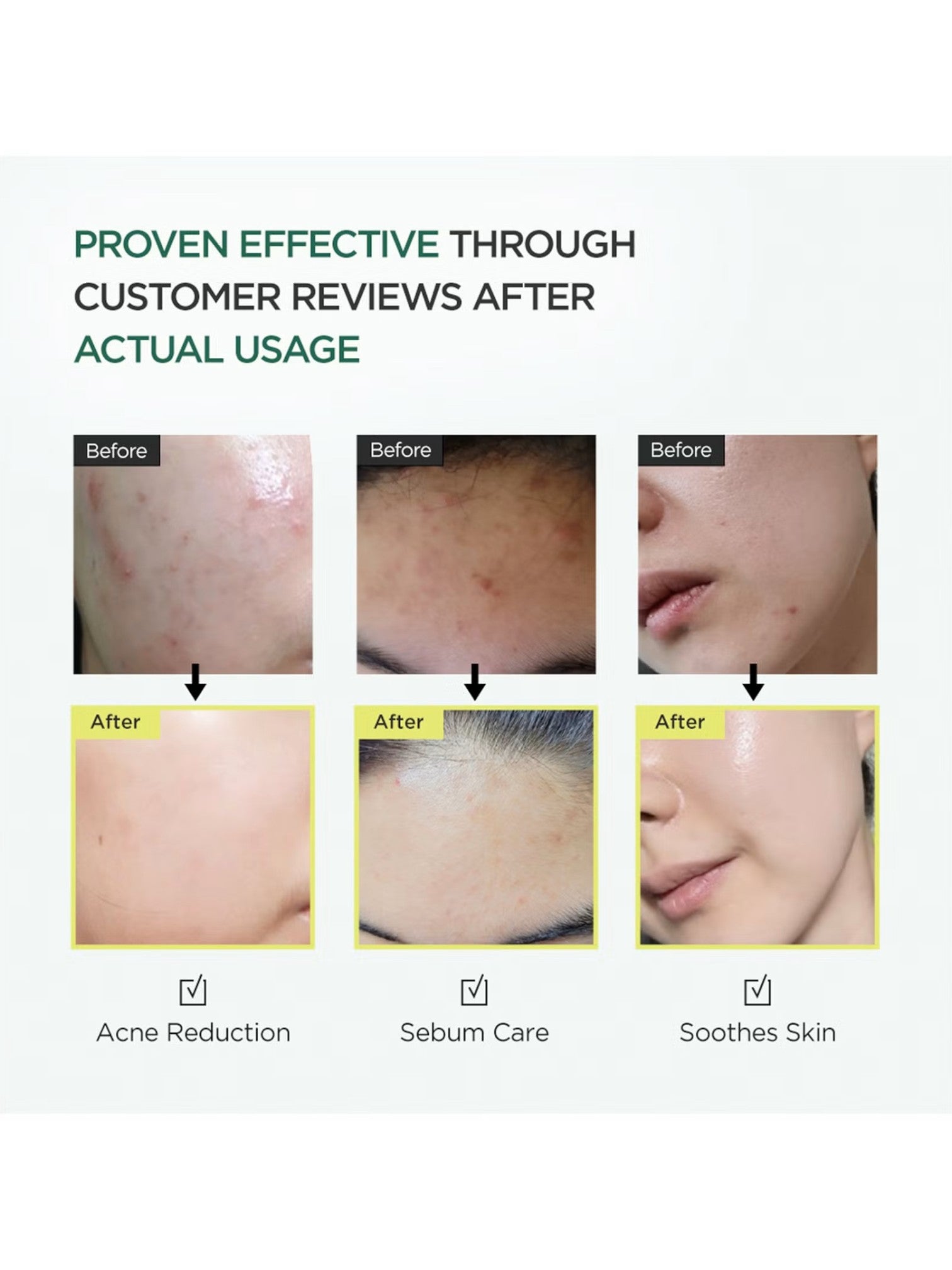Before and after skin improvement results with text Proven effective through customer reviews after actual usage. Anua, Monza Outlet, Monza Fashion, Shein Outlet