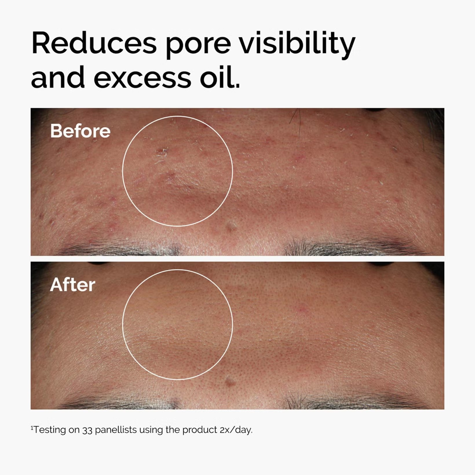 Before and after comparison of skin with pore visibility and excess oil reduction, using a product tested on 33 panelists. Monza fashion outlet, monza outlet, shein outlet, shien outlet cosmetics, makeup, perfume