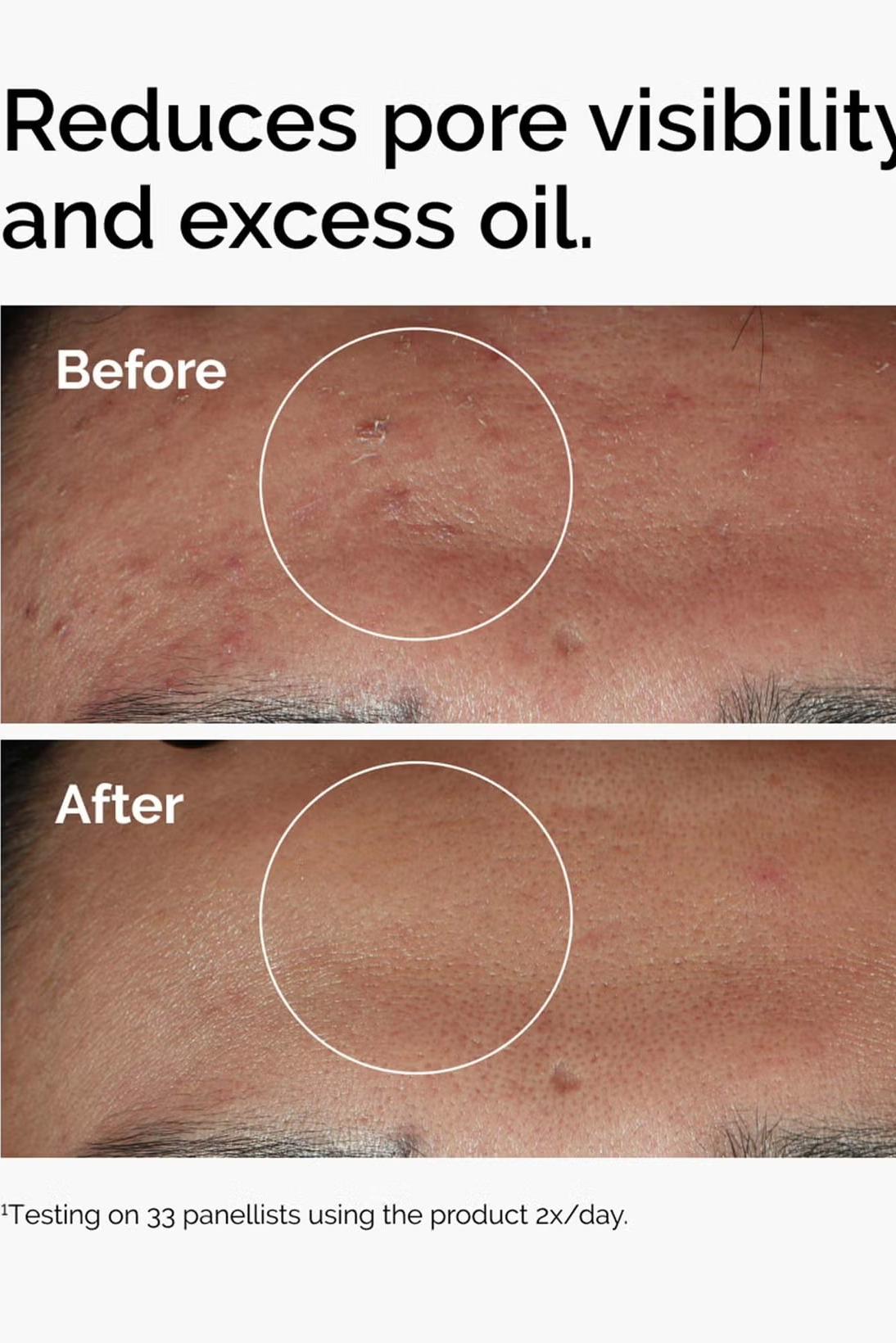 Before and after comparison of skin with pore visibility and excess oil reduction, using a product tested on 33 panelists. Monza fashion outlet, monza outlet, shein outlet, shien outlet cosmetics, makeup, perfume