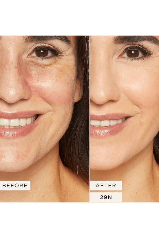 Before and after comparison of a woman's face with visible skin improvement. Monza fashion outlet, monza outlet, shein outlet, shien outlet cosmetics, makeup, perfume
