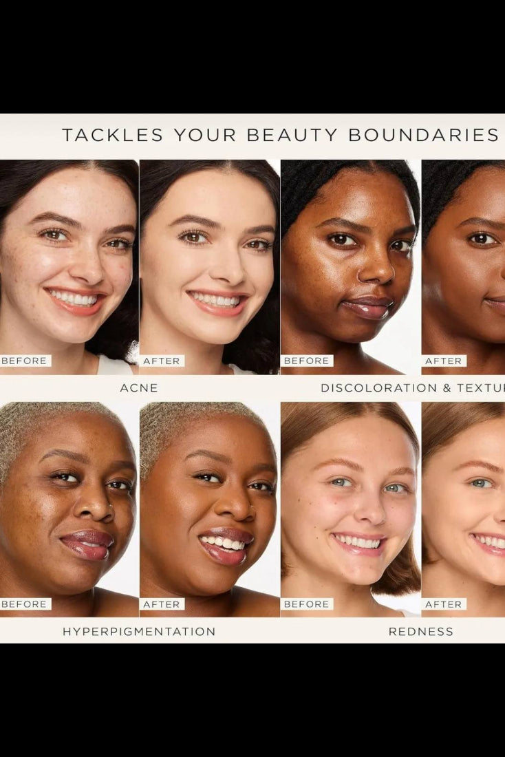 Before and after effects of a skincare product on various skin types. Monza fashion outlet, monza outlet, shein outlet, shien outlet cosmetics, makeup, perfume