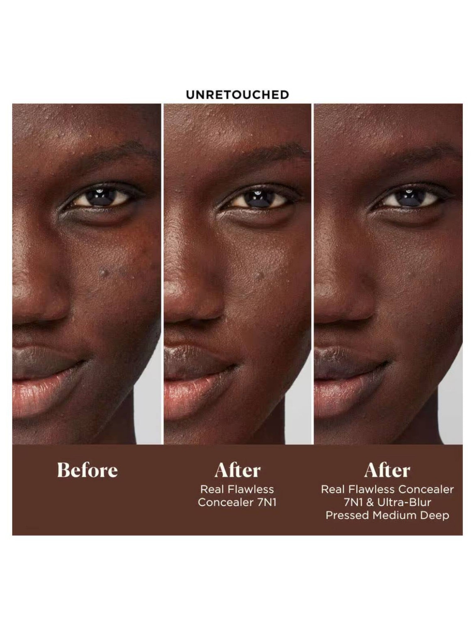 Before and after comparison of a concealer application on a model's face. monza outlet, Shein outlet, monza fashion